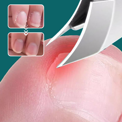 🔥Oferta🔥 Cortaúñas antisalpicaduras con borde inclinado de 25° (juego de 3 piezas)